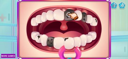 有趣的牙医手术游戏安卓版（Fun dentist surgery）