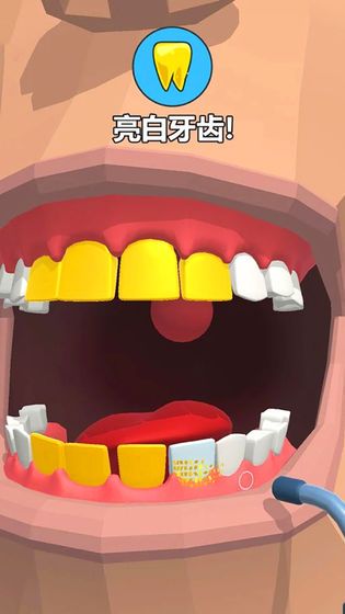 拔牙大师游戏
